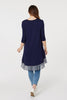 Navy | Border Print Drop Hem Tunic Top